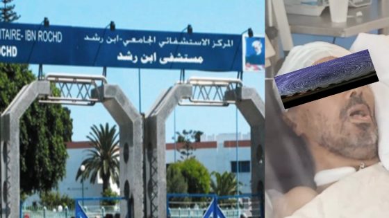 مستشفى ابن رشد بالدار البيضاء …زيارة علاجية تتحول إلى مأساة إنسانية